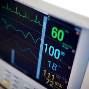 I ritmi cardiaci irregolari della bigeminalità