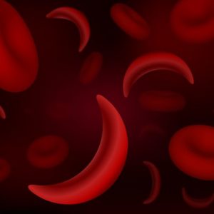 10 sintomi dell’anemia falciforme