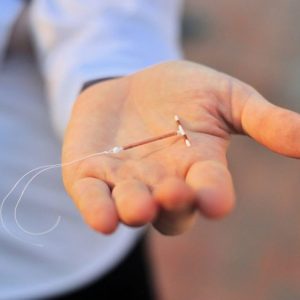 Cosa le donne devono sapere sugli IUD