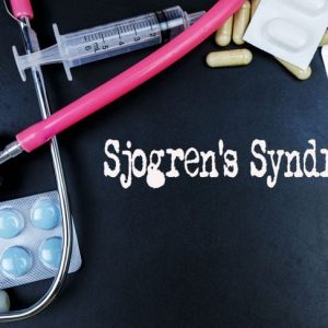 Sintomi e trattamenti della sindrome di Sjogren