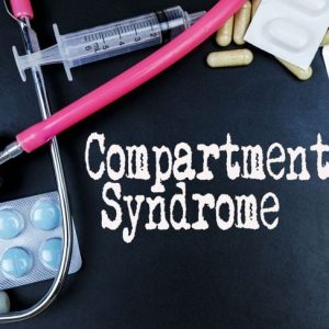 Trattamenti per la sindrome compartimentale