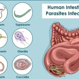 Infezioni da tricocefali: Cause, sintomi e trattamenti