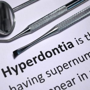 Hyperdontia: Are Extra Teeth a Problem?