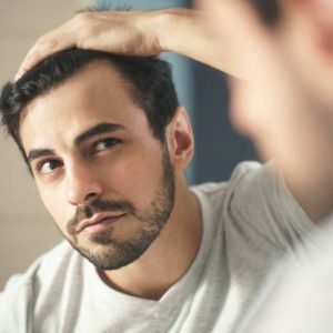 Domande frequenti sulla perdita di capelli diffusa