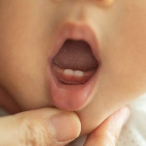 Cronologia della dentizione dal bambino all’adulto