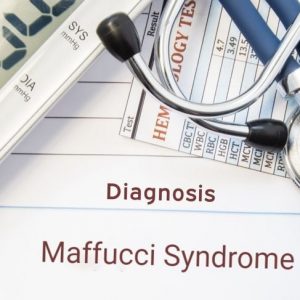 Sindrome di Maffucci: Cause, sintomi e trattamento